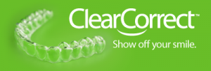 Example of ClearConnect™ clear braces used by Prairie Dental Care in Vancouver, WA